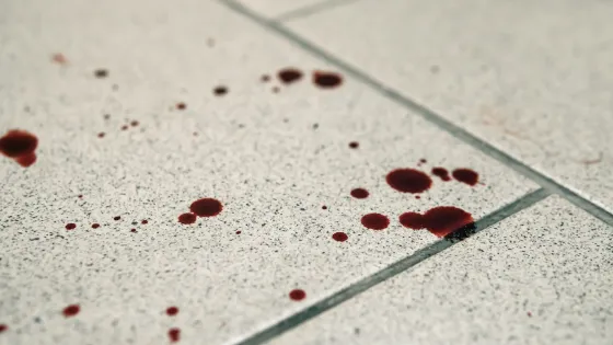 How to remove blood from ceramic tiles?